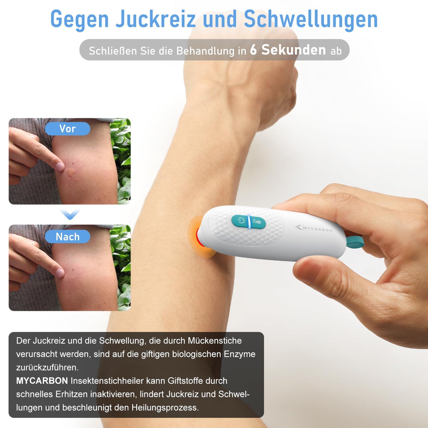 MYCARBON Insect Bite Healer: Heat Stick Treatment of Itching & Pain & Swelling